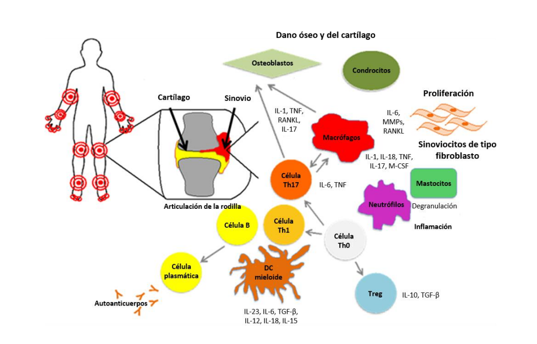 Artritis reumatoide Figure 1 