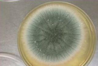 Aspergillus fumigatus