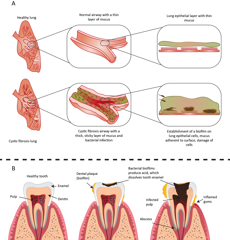 Biofilm Figure 3