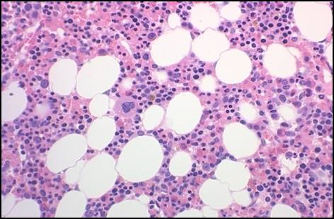 Bone Marrow Figure 1.