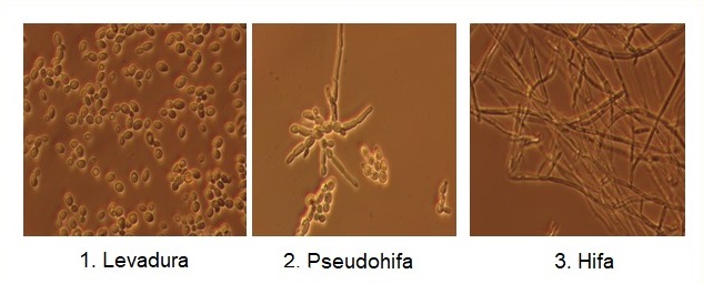 Candida albicans Figura.1