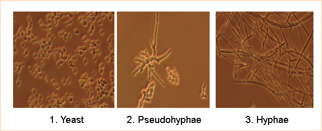 Candida albicans Figure.1