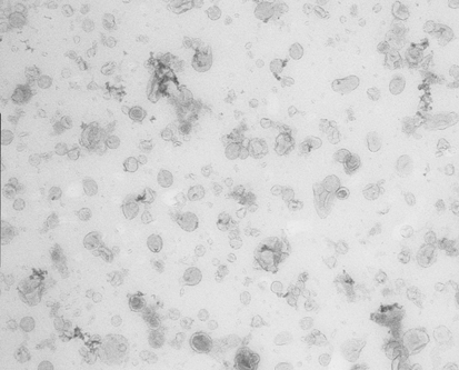 Exosomes in cancer immunology Figure 1