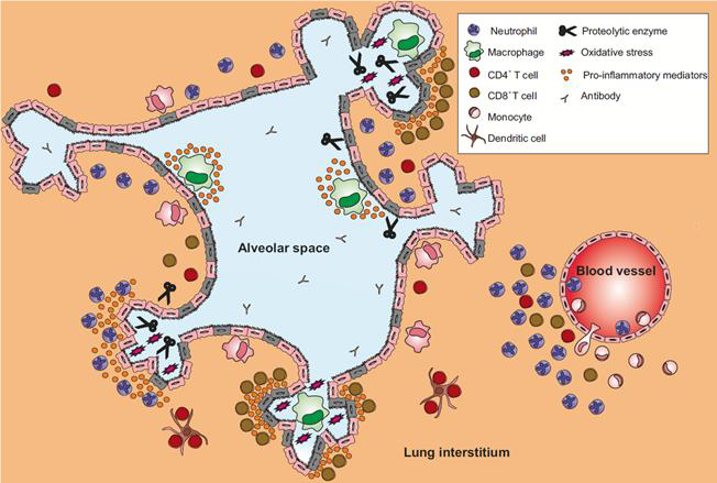 Immune response to COPD Figure.2