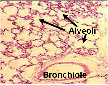 Immunity in the lung Figure.1