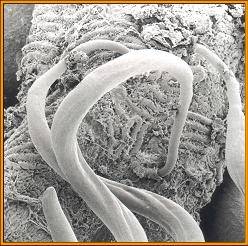 Intestinal nematode parasites Figure.2 
