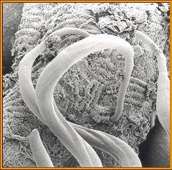 Intestinal nematode parasites Figure.2