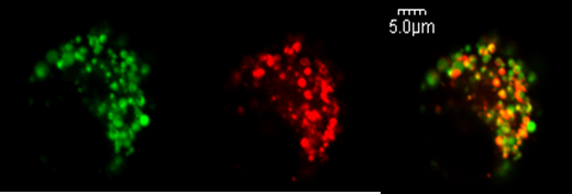 Laser Confocal Microscopy Image 1