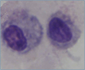 Lung Macrophages