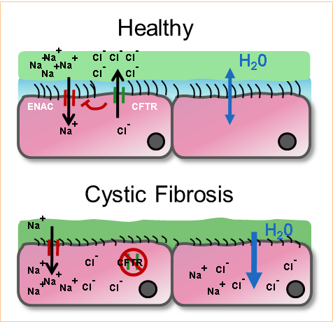 Microbial infection in cystic fibrosis Figure.1
