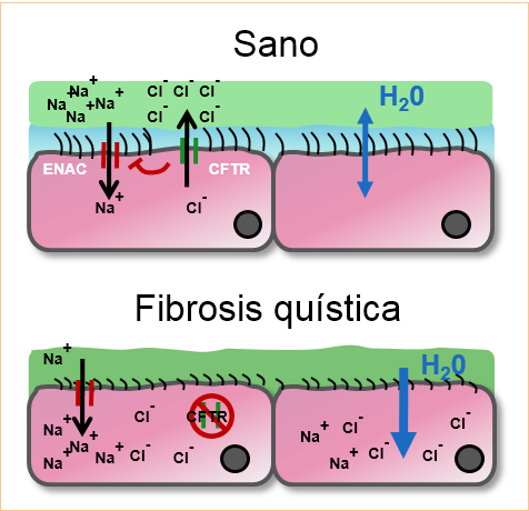 Microbial infection in cystic fibrosis Figura.1