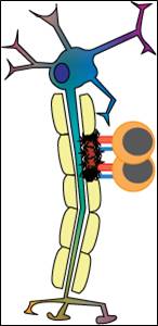 Multiple Sclerosis Figure 1