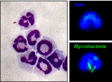 Neutrophils Figure 1 