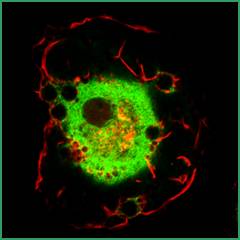 Phagocytosis Figure 2 