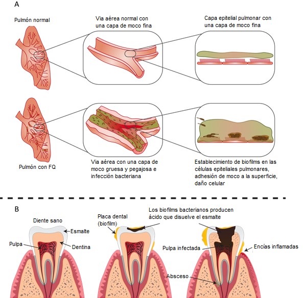 Biofilm Figura 3