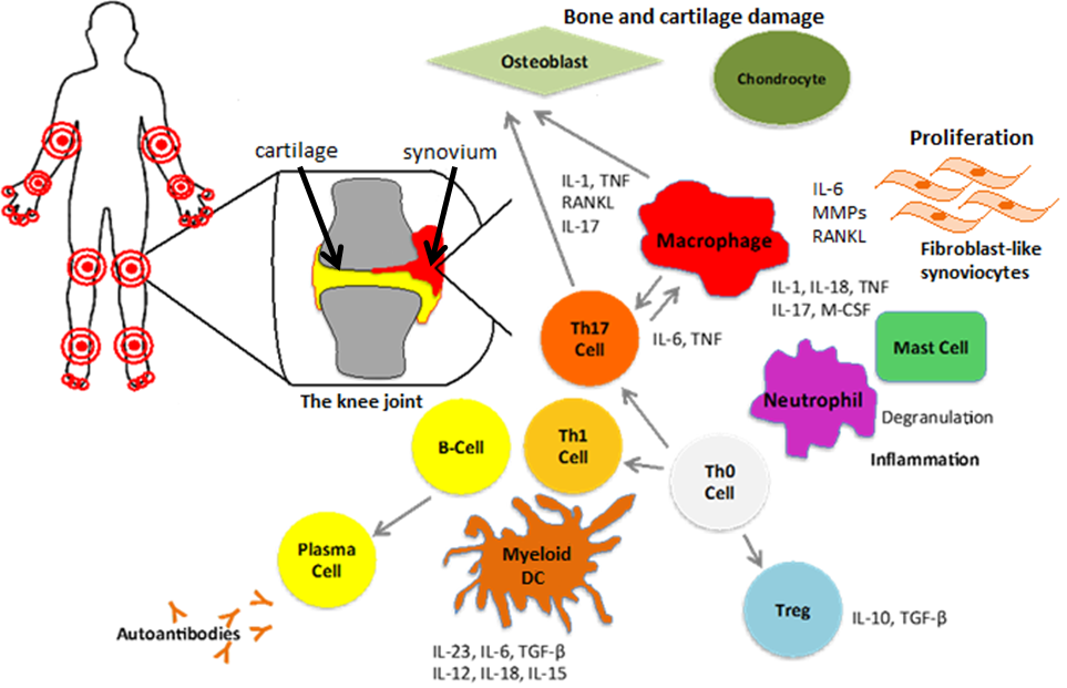 Pathophysiology Of Rheumatoid Arthritis Diagram