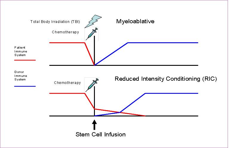 Stem cell transplantation figure 1.