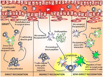 Transplant rejection The cell paradigm Figure.2