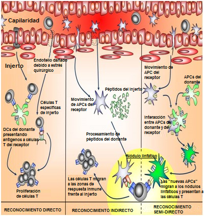 Transplant rejection - The cell paradigm Figure.2