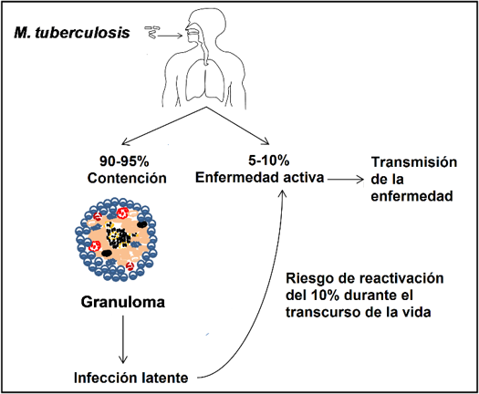 Tuberculosis Figura.1