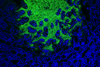 Figure 1. Macrophages