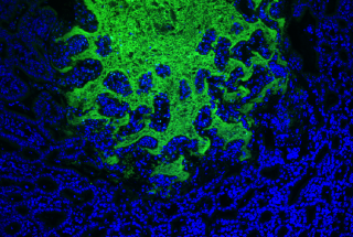 Figure 1. Macrophages 