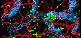 Sensory Neurons Dendritic Cells