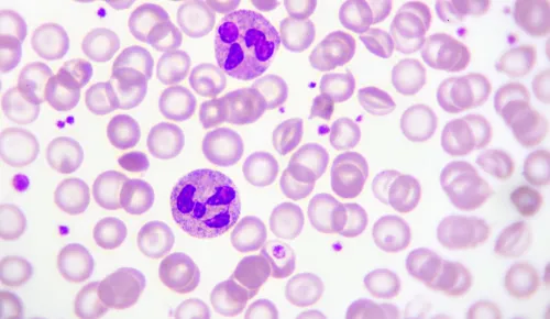 Neutrophils in blood smear
