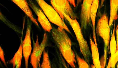 Human skin cells