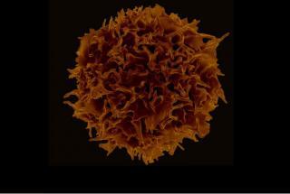 Regulatory T Cells (Tregs)