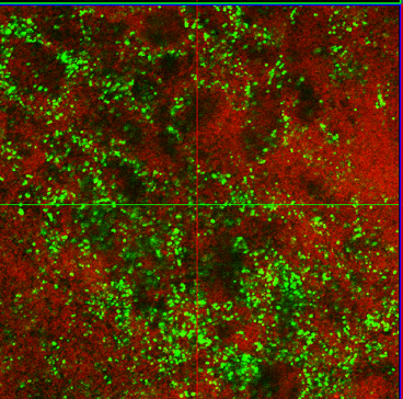 Biofilm Figure 1