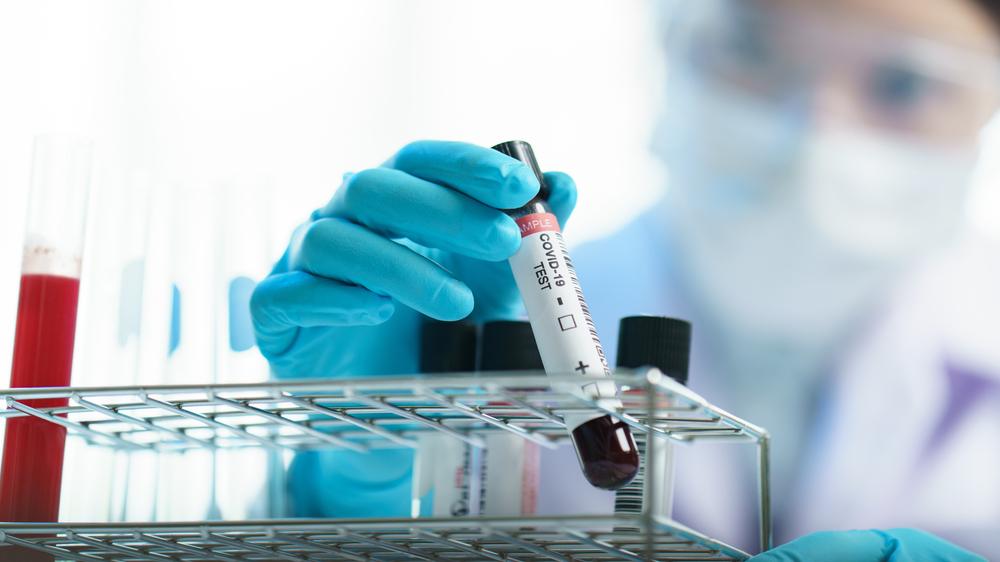 COVID Blood sample - Shutterstock credit MBLifestyle