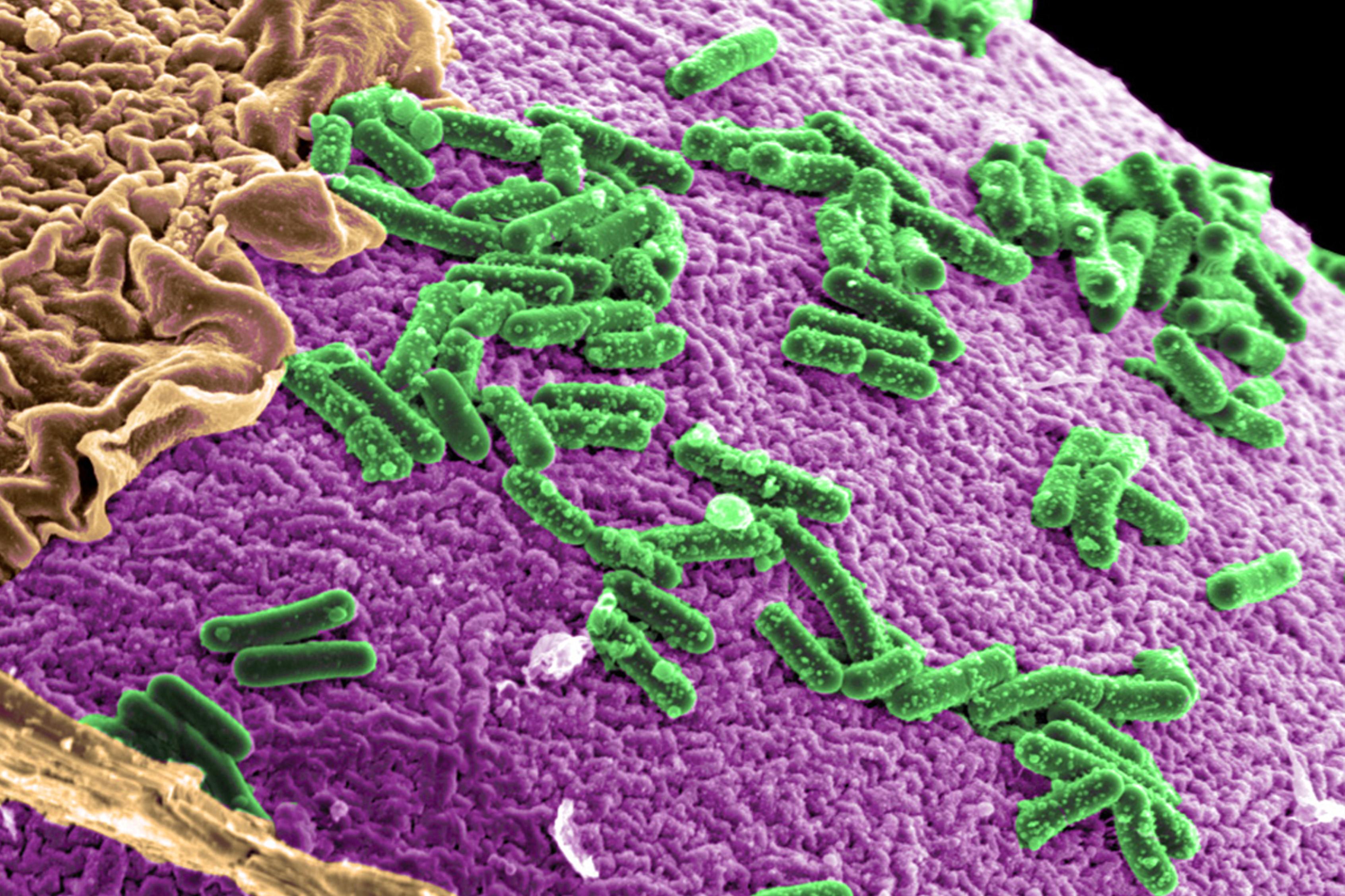 Gut microbe. Image credit: NIAID