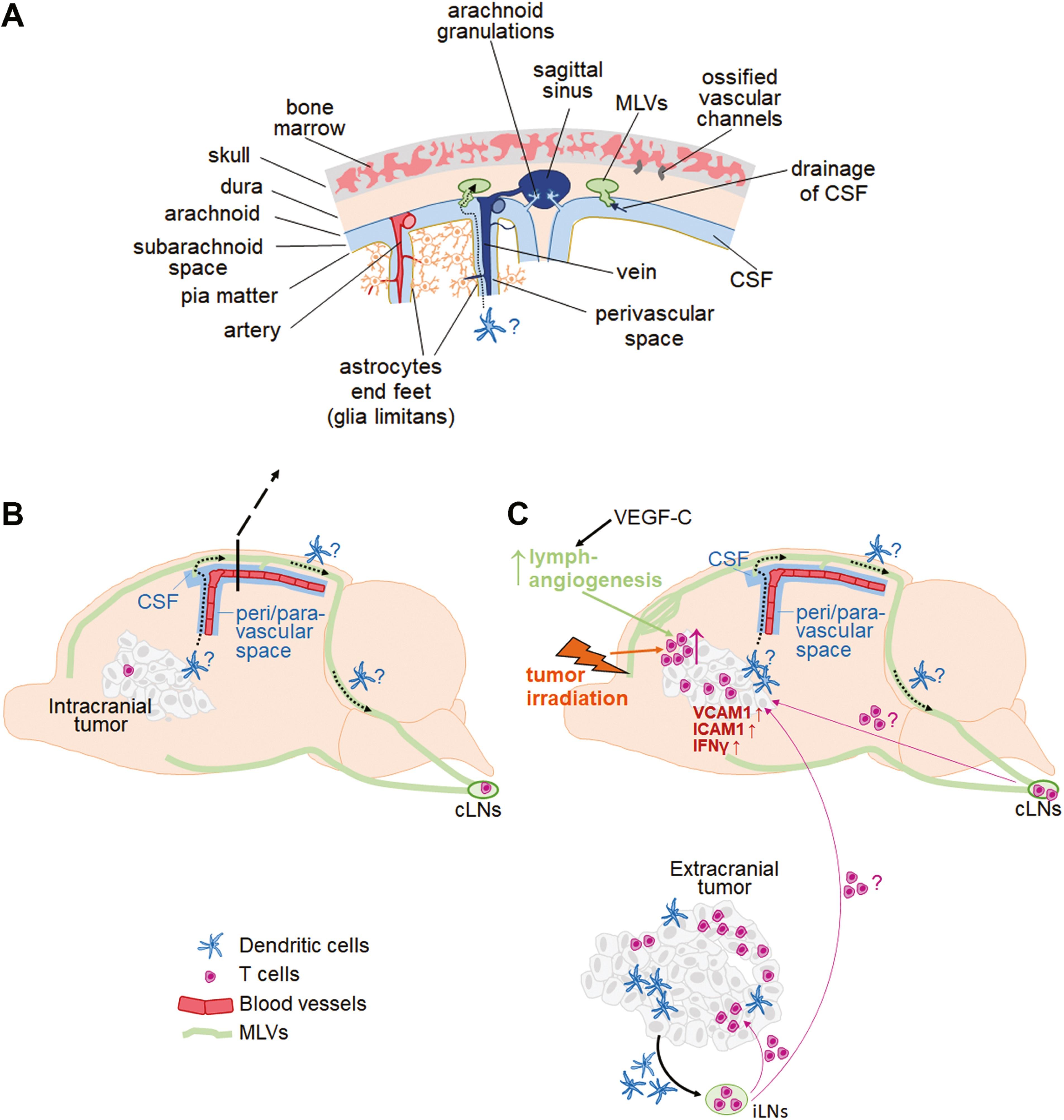 Figure from Immunotherapy in the context of immune-specialized environment of brain metastases
