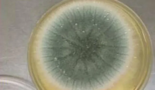 Aspergillus fumigatus