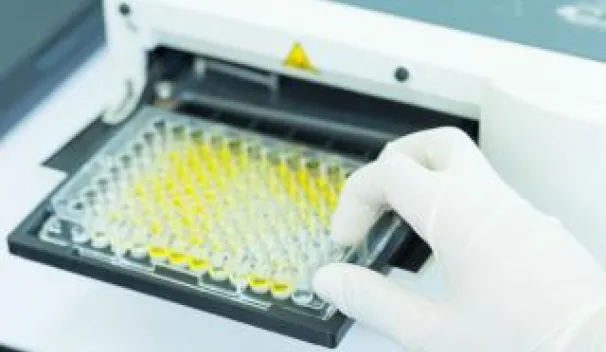 Enzyme-linked immunosorbent assay (ELISA)