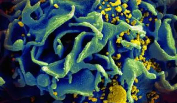 Human Immunodeficiency Virus