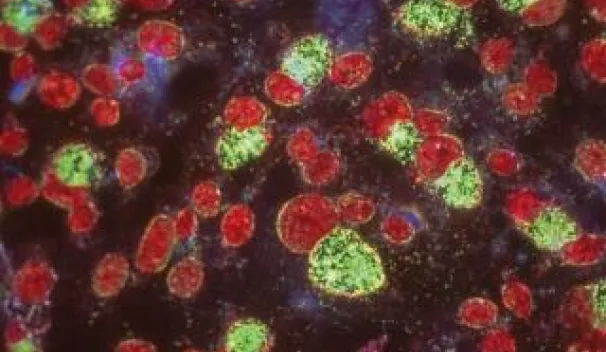 Chlamydia Trachomatis