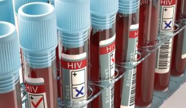HIV 1 Vaccines 