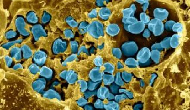 Host − Pathogen interactions and immune evasion