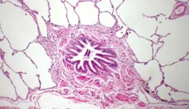 Immunity in the lung