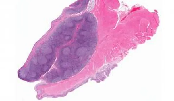 Immunity in the salivary gland