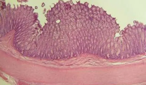 Innate immunity in the large intestine