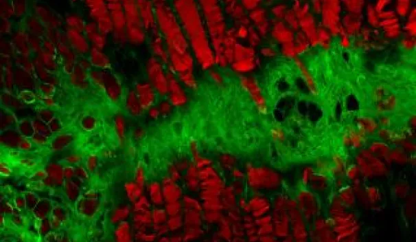 Laser Confocal Microscopy