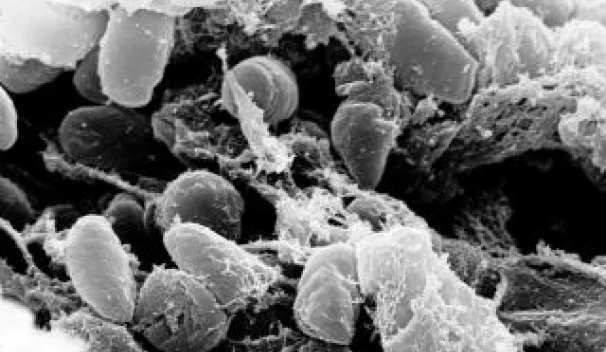 Pathogenic Yersiniae