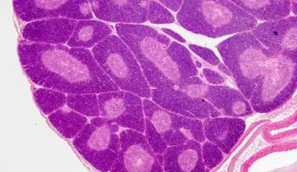 T-cell development in thymus